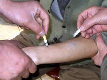 酷刑演示：烟头烧烫